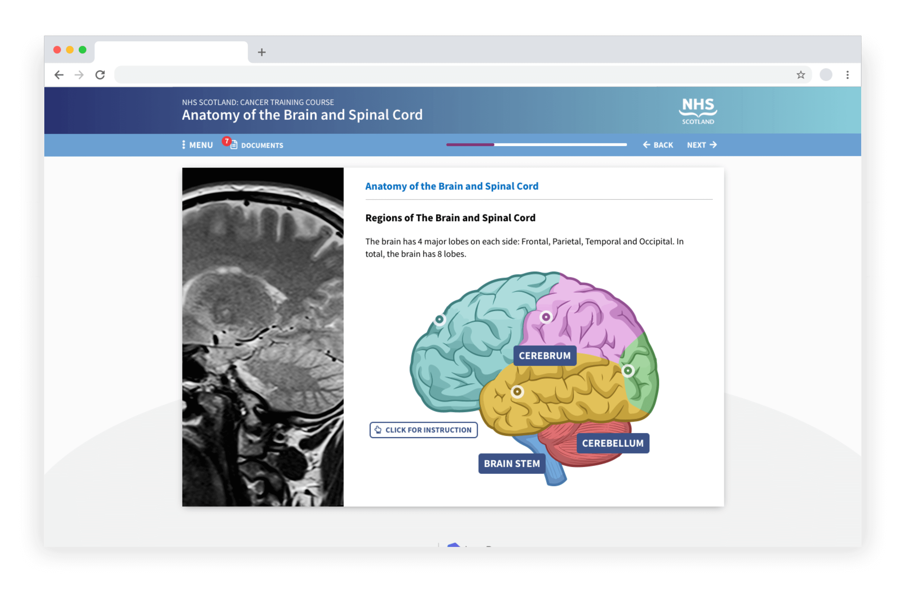 Example e-learning showing an Anatomy of the Brain and Spinal Cord course developed in LAB Advanced